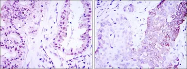 Anti-CRTC3 antibody [5G9] used in IHC (Paraffin sections) (IHC-P). GTX60400