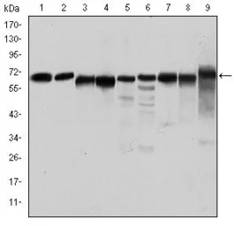 Anti-AMPK alpha 1 antibody [2B7] used in Western Blot (WB). GTX60403