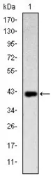 Anti-CD94 antibody [1H1] used in Western Blot (WB). GTX60405