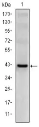 Anti-CD94 antibody [3G2] used in Western Blot (WB). GTX60406