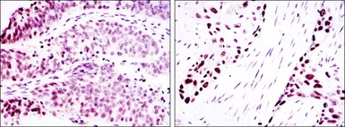 Anti-p63 antibody [4E5] used in IHC (Paraffin sections) (IHC-P). GTX60407