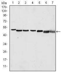 Anti-p63 antibody [4E5] used in Western Blot (WB). GTX60407