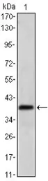 Anti-Musashi 1 antibody [2A12] used in Western Blot (WB). GTX60408