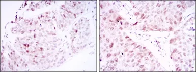 Anti-CDC2 antibody [2G9] used in IHC (Paraffin sections) (IHC-P). GTX60412