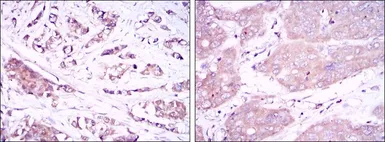 Anti-Beclin 1 antibody [2A4] used in IHC (Paraffin sections) (IHC-P). GTX60413