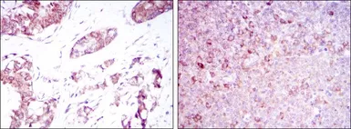 Anti-BMPR2 antibody [1F12] used in IHC (Paraffin sections) (IHC-P). GTX60414