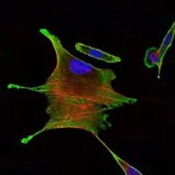 Anti-BMPR2 antibody [3F6] used in Immunocytochemistry/ Immunofluorescence (ICC/IF). GTX60415