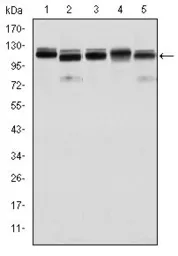 Anti-BMPR2 antibody [3F6] used in Western Blot (WB). GTX60415