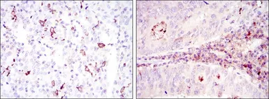 Anti-CD1a antibody [7A7] used in IHC (Paraffin sections) (IHC-P). GTX60418