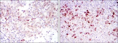 Anti-Cortactin antibody [4C6] used in IHC (Paraffin sections) (IHC-P). GTX60419