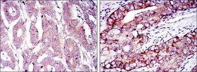 Anti-eIF4E antibody [5D11] used in IHC (Paraffin sections) (IHC-P). GTX60420