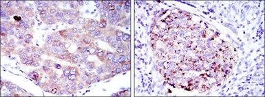 Anti-eEF2 antibody [5B6] used in IHC (Paraffin sections) (IHC-P). GTX60421