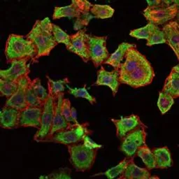 Anti-RBP4 antibody [4C2] used in Immunocytochemistry/ Immunofluorescence (ICC/IF). GTX60427