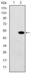 Anti-RBP4 antibody [4C2] used in Western Blot (WB). GTX60427