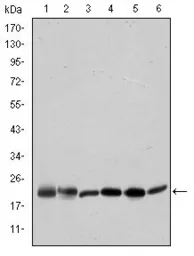 Anti-Bid antibody [3C5] used in Western Blot (WB). GTX60429