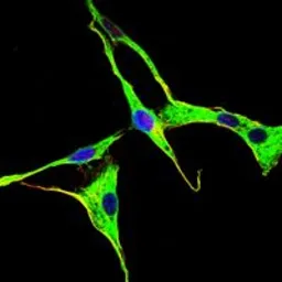 Anti-GRK2 antibody [3F8] used in Immunocytochemistry/ Immunofluorescence (ICC/IF). GTX60430