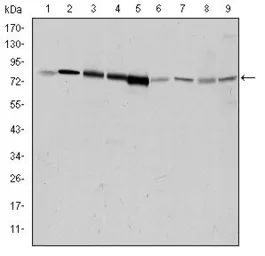 Anti-GRK2 antibody [3F8] used in Western Blot (WB). GTX60430