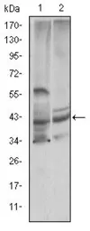 Anti-Cystatin C antibody [5H2] used in Western Blot (WB). GTX60432