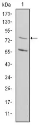 Anti-MTHFR antibody [5D3] used in Western Blot (WB). GTX60435