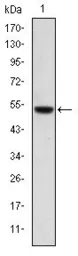 Anti-PODXL antibody [5D4] used in Western Blot (WB). GTX60436