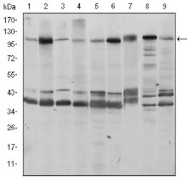 Anti-FUK antibody [6E2] used in Western Blot (WB). GTX60438
