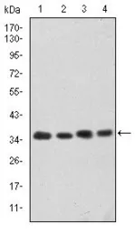 Anti-CDK5 antibody [4E4] used in Western Blot (WB). GTX60441