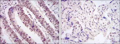 Anti-CDK9 antibody [1B5A7] used in IHC (Paraffin sections) (IHC-P). GTX60442