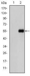 Anti-CD105 antibody [3A9] used in Western Blot (WB). GTX60452