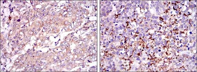 Anti-SMN1 antibody [5H1] used in IHC (Paraffin sections) (IHC-P). GTX60453