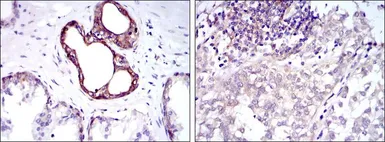 Anti-NFkB p105/p50 antibody [5D10] used in IHC (Paraffin sections) (IHC-P). GTX60455