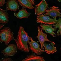 Anti-ASK1 antibody [2E4] used in Immunocytochemistry/ Immunofluorescence (ICC/IF). GTX60456