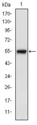 Anti-ASK1 antibody [2E4] used in Western Blot (WB). GTX60456