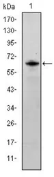 Anti-FYN antibody [2A10] used in Western Blot (WB). GTX60460