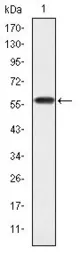 Anti-CrkL antibody [5E12] used in Western Blot (WB). GTX60462