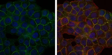 Anti-BLNK antibody [5G9] used in Immunocytochemistry/ Immunofluorescence (ICC/IF). GTX60463
