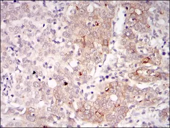 Anti-BLNK antibody [5G9] used in IHC (Paraffin sections) (IHC-P). GTX60463