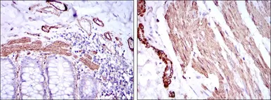 Anti-alpha Smooth Muscle Actin antibody [4A4] used in IHC (Paraffin sections) (IHC-P). GTX60466