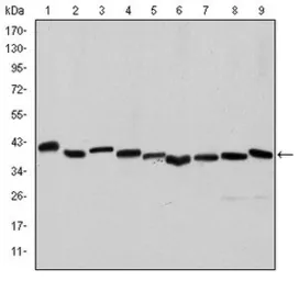 Anti-alpha Smooth Muscle Actin antibody [4A4] used in Western Blot (WB). GTX60466