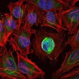 Anti-MMP1 antibody [6A5] used in Immunocytochemistry/ Immunofluorescence (ICC/IF). GTX60467