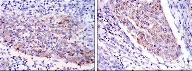 Anti-MMP1 antibody [6A5] used in IHC (Paraffin sections) (IHC-P). GTX60467