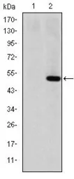 Anti-MMP1 antibody [6A5] used in Western Blot (WB). GTX60467
