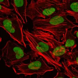 Anti-Ku80 antibody [5C5] used in Immunocytochemistry/ Immunofluorescence (ICC/IF). GTX60468