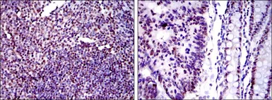 Anti-Ku80 antibody [5C5] used in IHC (Paraffin sections) (IHC-P). GTX60468