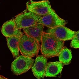 Anti-LIMS1 antibody [5G7] used in Immunocytochemistry/ Immunofluorescence (ICC/IF). GTX60472