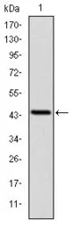 Anti-LIMS1 antibody [5G7] used in Western Blot (WB). GTX60472