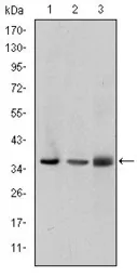 Anti-LIMS1 antibody [5G7] used in Western Blot (WB). GTX60472