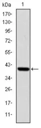 Anti-ITK antibody [5G6] used in Western Blot (WB). GTX60475