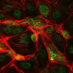 Anti-c-Jun antibody [5B1] used in Immunocytochemistry/ Immunofluorescence (ICC/IF). GTX60477