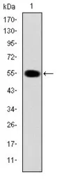 Anti-IRAK4 antibody [2H9] used in Western Blot (WB). GTX60479