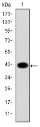 Anti-Cytokeratin 19 antibody [4E8] used in Western Blot (WB). GTX60480